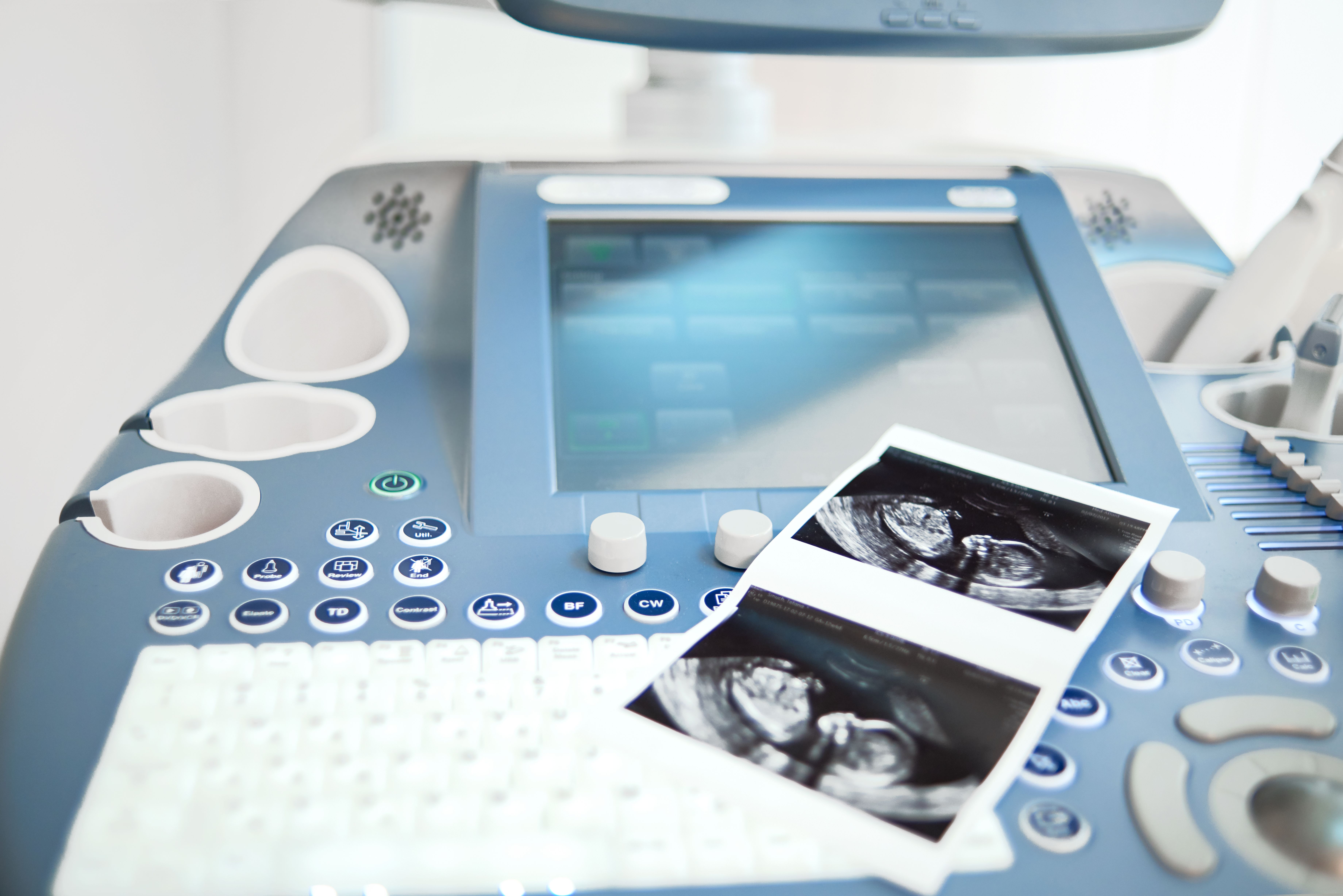 Пробный курс по «Методике и правилам проведения пренатального ультразвукового скрининга I триместра беременности. Возможные ВПР в I триместре»