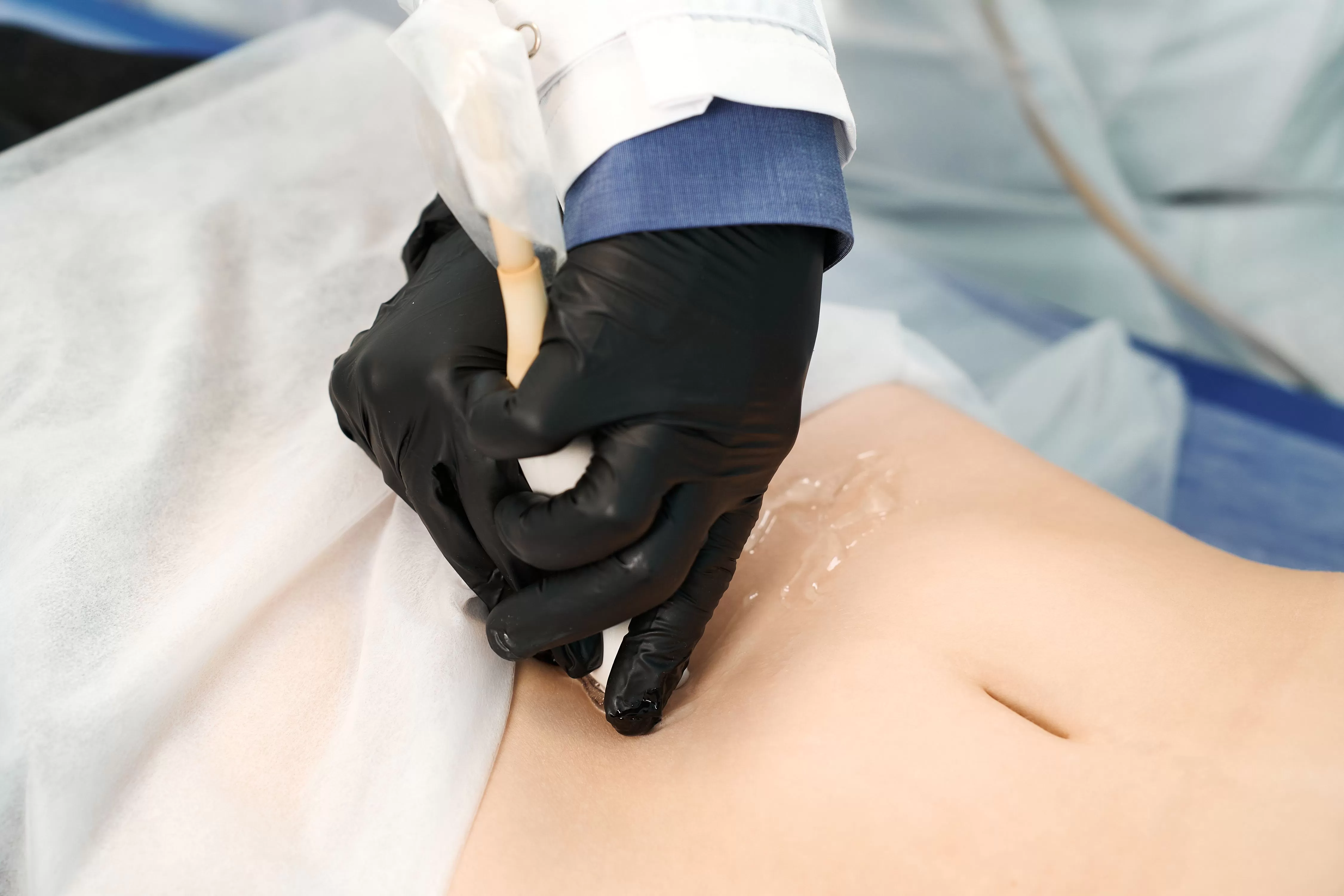 Пробный курс по «УЗИ органов малого таза: для гинекологов и не только»